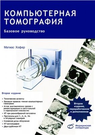 Компьютерная томография. Базовое руководство (2011) PDF